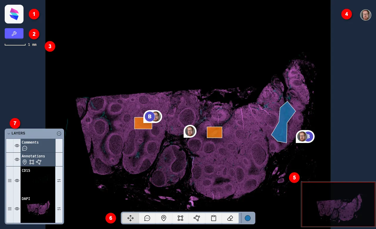 The StackViewer